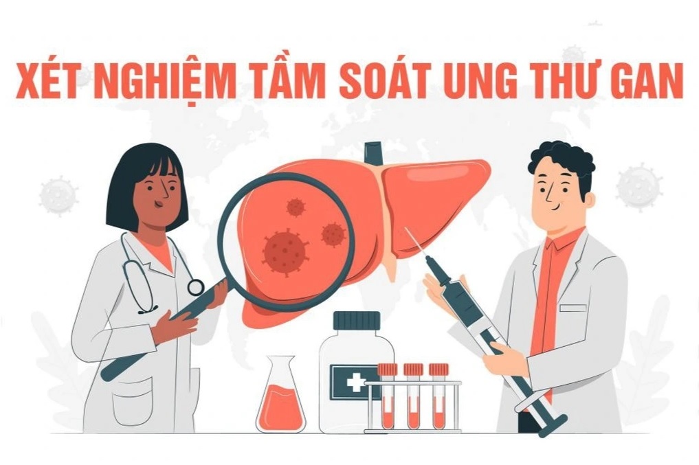 xn tam soat u thu gan